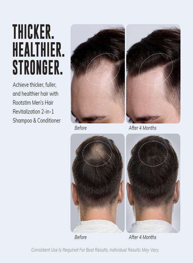 RootStim Hair Thickening & Anti Hair Loss Shampoo with DHT Blocker for Men's Hair Growth - 2-in-1 Anti Thinning Shampoo & Conditioner with Biotin, Saw Palmetto & Rosemary for Fuller Hair, Sulfate-Free, 10oz - Image 4